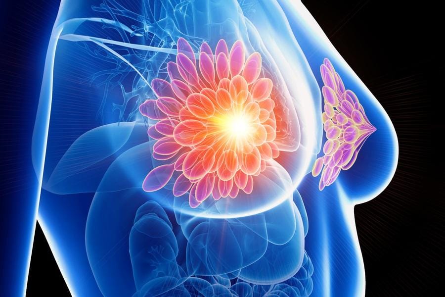 Dépistage cancer du sein : mammographie 3D